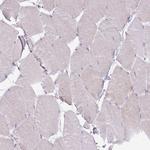 TCP-1 zeta Antibody in Immunohistochemistry (Paraffin) (IHC (P))