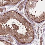 TCP-1 zeta Antibody in Immunohistochemistry (Paraffin) (IHC (P))