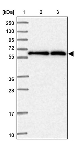 TCP-1 zeta Antibody in Western Blot (WB)