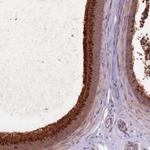 EDDM3A Polyclonal Antibody