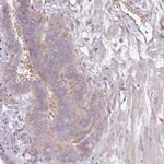 OR2V2 Polyclonal Antibody