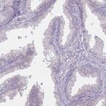 OR2V2 Antibody in Immunohistochemistry (Paraffin) (IHC (P))