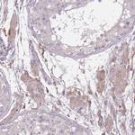 OR2V2 Antibody in Immunohistochemistry (Paraffin) (IHC (P))