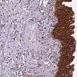 TUSC3 Polyclonal Antibody