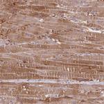 PRKAR1A Antibody in Immunohistochemistry (Paraffin) (IHC (P))