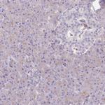 PRKAR1A Antibody in Immunohistochemistry (Paraffin) (IHC (P))