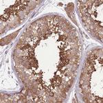 PRKAR1A Antibody in Immunohistochemistry (Paraffin) (IHC (P))