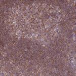 PRKAR1A Antibody in Immunohistochemistry (Paraffin) (IHC (P))