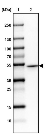 PRKAR1A Antibody in Western Blot (WB)