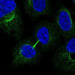 MRRF Polyclonal Antibody