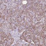 C7orf28A Antibody in Immunohistochemistry (Paraffin) (IHC (P))
