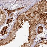 RANBP9 Polyclonal Antibody