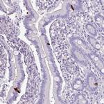 ZNF334 Antibody in Immunohistochemistry (Paraffin) (IHC (P))