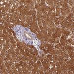 MTHFD1 Polyclonal Antibody