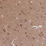 LYRM7 Antibody in Immunohistochemistry (Paraffin) (IHC (P))