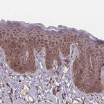 LYRM7 Antibody in Immunohistochemistry (Paraffin) (IHC (P))