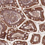 LYRM7 Antibody in Immunohistochemistry (Paraffin) (IHC (P))