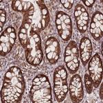 LYRM7 Antibody in Immunohistochemistry (IHC)