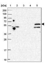 TRIM32 Antibody in Western Blot (WB)