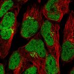 ZN576 Polyclonal Antibody