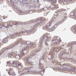 ZN576 Antibody in Immunohistochemistry (Paraffin) (IHC (P))