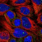 PXMP4 Polyclonal Antibody