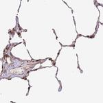 PXMP4 Antibody in Immunohistochemistry (IHC)