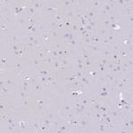 GOLGA6B Antibody in Immunohistochemistry (Paraffin) (IHC (P))
