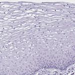 GOLGA6B Antibody in Immunohistochemistry (Paraffin) (IHC (P))