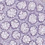 GOLGA6B Antibody in Immunohistochemistry (Paraffin) (IHC (P))