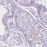 GOLGA6B Antibody in Immunohistochemistry (Paraffin) (IHC (P))