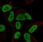 FAM182B Polyclonal Antibody