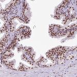 FAM182B Antibody in Immunohistochemistry (Paraffin) (IHC (P))