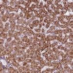 PEX11B Polyclonal Antibody