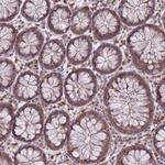 CXorf38 Antibody in Immunohistochemistry (Paraffin) (IHC (P))