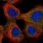 CXorf38 Polyclonal Antibody