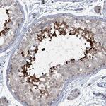 BIVM Antibody in Immunohistochemistry (Paraffin) (IHC (P))
