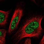 GLYR1 Antibody in Immunocytochemistry (ICC/IF)