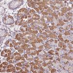 FAM58A Polyclonal Antibody