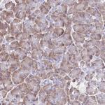 VSIG2 Antibody in Immunohistochemistry (Paraffin) (IHC (P))