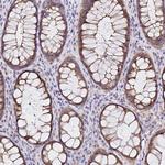 VSIG2 Antibody in Immunohistochemistry (Paraffin) (IHC (P))