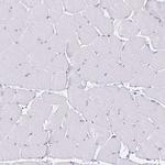 VSIG2 Antibody in Immunohistochemistry (Paraffin) (IHC (P))