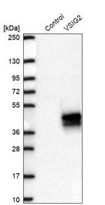 VSIG2 Antibody in Western Blot (WB)