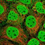 SRA1 Polyclonal Antibody