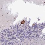 KCTD16 Antibody in Immunohistochemistry (Paraffin) (IHC (P))