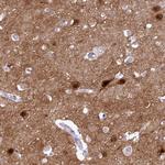 KCTD16 Antibody in Immunohistochemistry (Paraffin) (IHC (P))