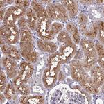 KCTD16 Antibody in Immunohistochemistry (Paraffin) (IHC (P))