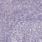 KCTD16 Antibody in Immunohistochemistry (Paraffin) (IHC (P))