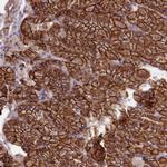 MRPL46 Antibody in Immunohistochemistry (Paraffin) (IHC (P))