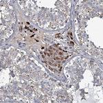 C4orf29 Antibody in Immunohistochemistry (Paraffin) (IHC (P))